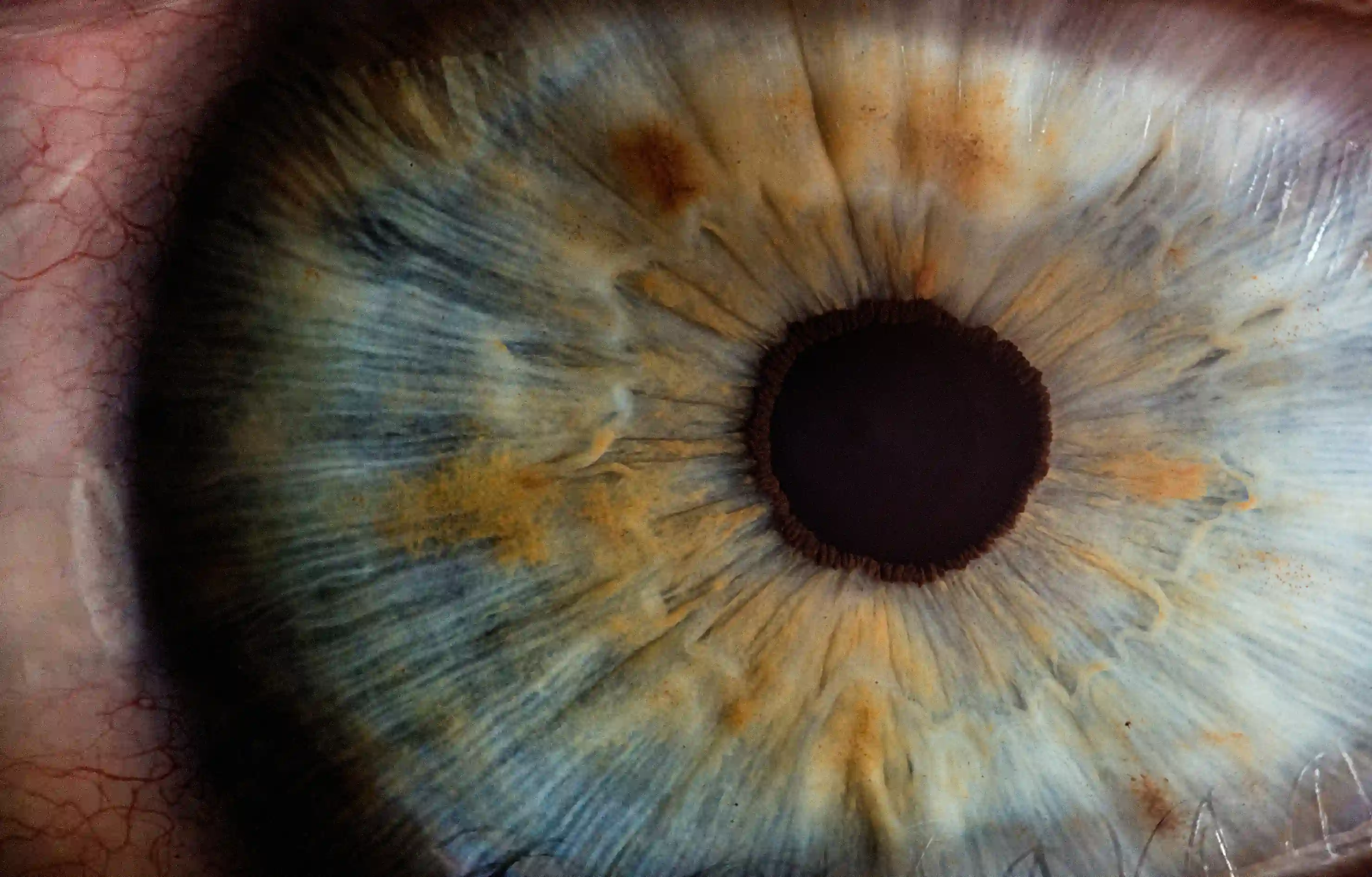 The Eye They Tried to Close